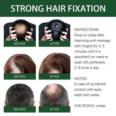 Picture of Ginger oil Hair (Oil) Growth Therapy Authentic and original 50ml