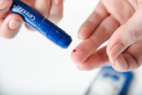 Picture of Blood Lancet Sterile Needle For Blood Glucose Meter Pen - 100pcs - Multicolor