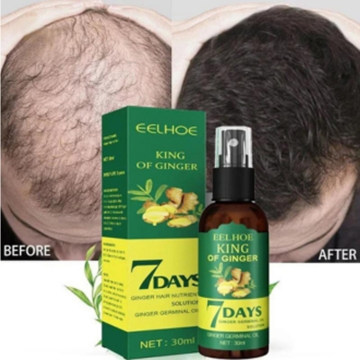 Picture of Organic Ginger Oil China Ginger Hair Growth Serum Sprayer Fast Hair Growth Dense Regrowth Ginger Serum Oil Natural Hair Growth Accelerator For Stronger