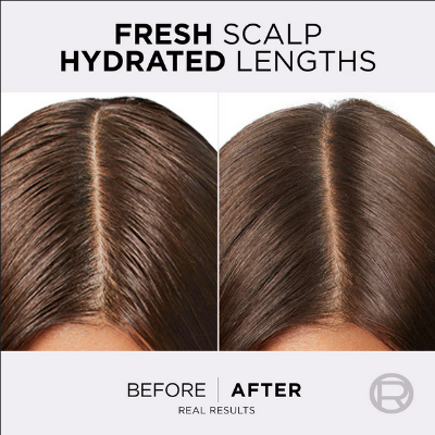 Picture of L'OREAL PARIS Elvive Hyaluron Moisture Shampoo For 400ML+ Conditioner 360ML For Frizzy & Dehydrated Hair