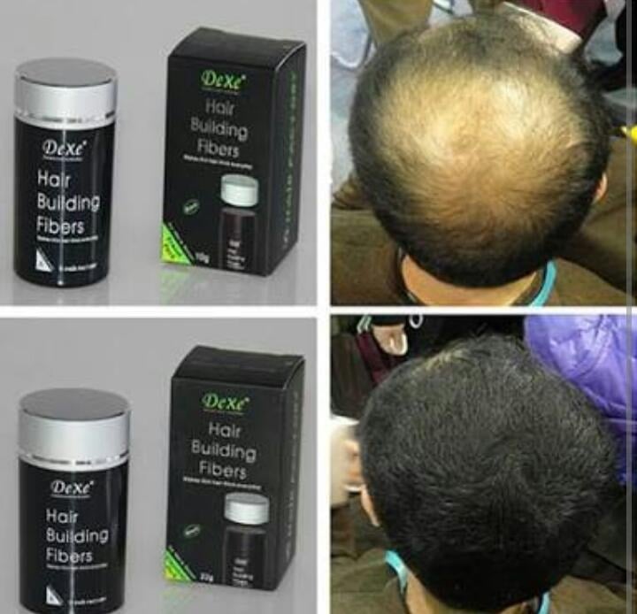 Picture of Dexe Hair Building Fiber Made in UK - Authentic Dexe Hair Fiber acces