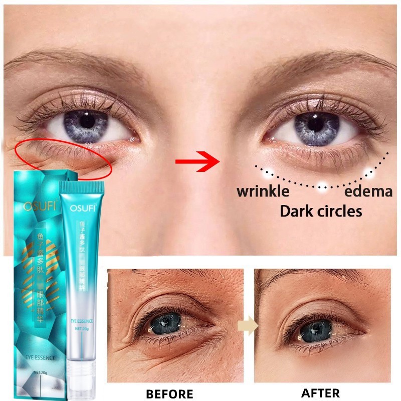 Picture of Osufi Eye Essence Cream 20 G