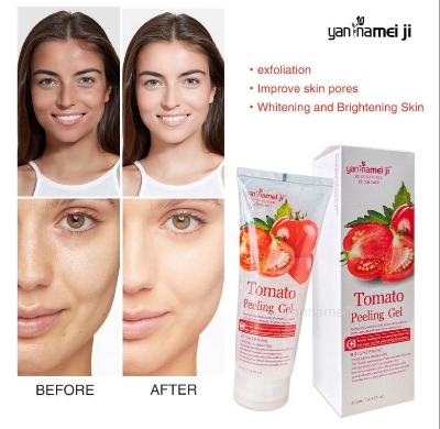 Picture of Yan Namei Ji Tomato Peeling Gel - Dead Skin Remover 320 ml