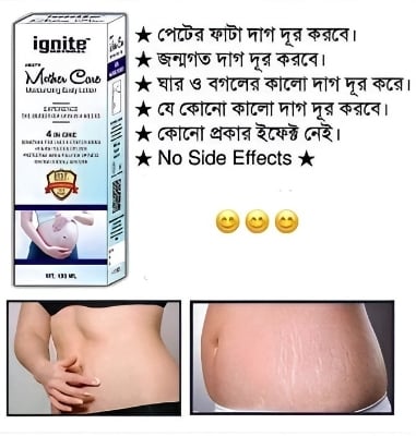 Picture of Natural Smooth Mother Care Moisturizing Body Lotion 100ML