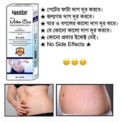 Picture of Natural Smooth Mother Care Moisturizing Body Lotion 100ML