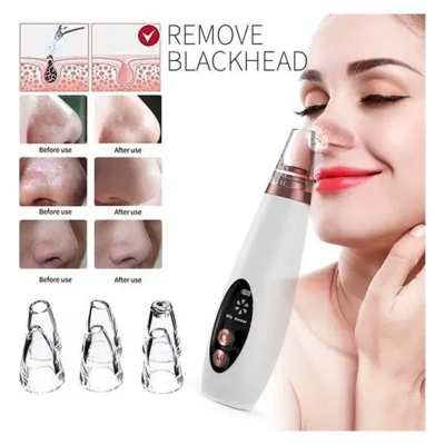 Picture of Blackhead Remover Instrument Black Dot Remover Acne Vacuum Suction Face Clean Black Head Pore Cleaning Beauty Skin Care Tool - Black Head Remover - Darma Roller