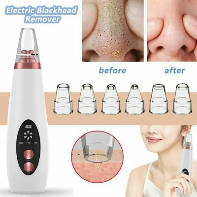 Picture of Rechargeable Electric Blackhead Remover Pimple Removing Tool - White - Face