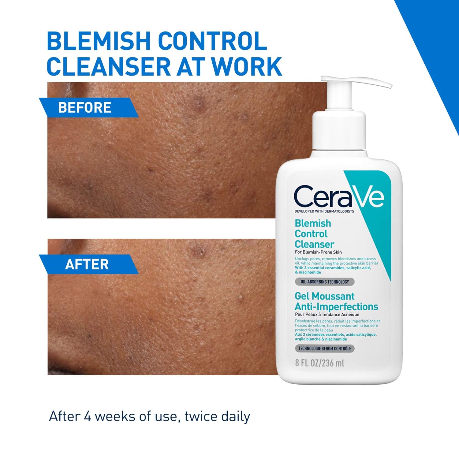 Picture of CeraVe Oil-Absorbing Blemish Control Cleanser for Acne-Prone Skin, 236ml-(OFF White)