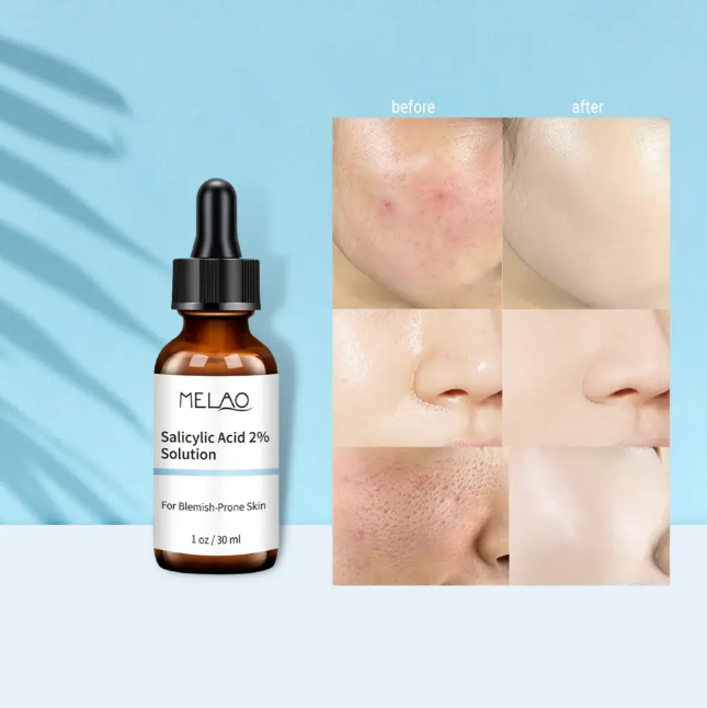 Picture of Melao Salicylic Acid 2% Solution – 30 ml