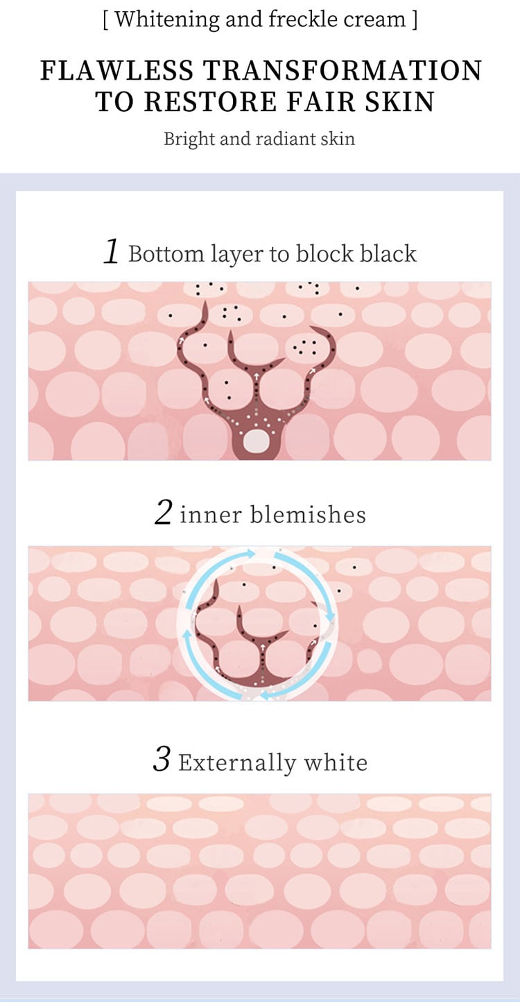 Picture of YOUBUY Whitening and Freckle Removing Cream