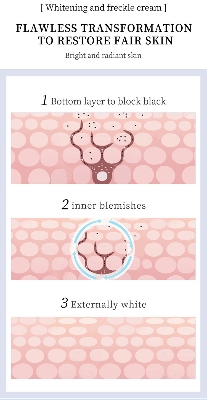 Picture of YOUBUY Whitening and Freckle Removing Cream