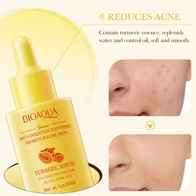 Picture of BIOAQUA Turmeric Facial Serum Anti-Oxidation Soothing Acne Skin Hyaluronic Acid Control Oil Moisturizing Face Skin-30ml