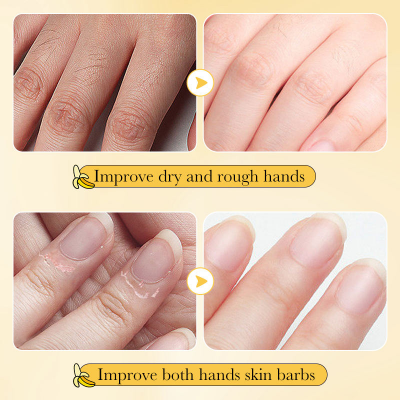 Picture of SADOER Anti-cracking Whitening Banana Nourishing Hand Cream  30g