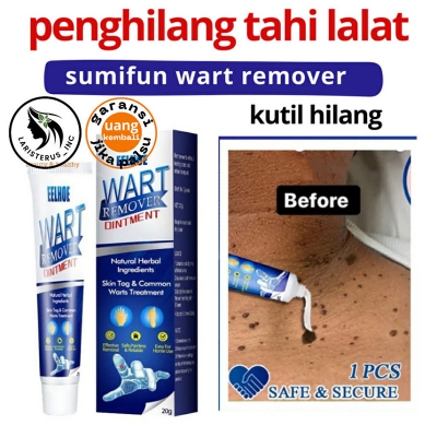 Picture of SUMIFUN WART REMOVER OINTMENT SKIN TAG NATURAL TREATMENT MOLES SAFE VERRUCA