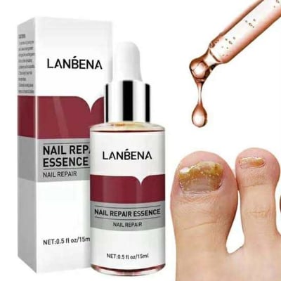 Picture of LANBENA Nail Repair Essence Serum Fungus Treatment Nail Removal Onychomycosis-15ml