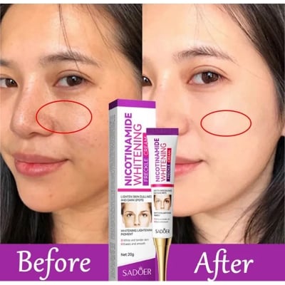 Picture of SADOER Niacinamide Whitening Freckle Cream Effectively Removes Melasma Lightens Black Spots Acne Marks Brightens Skin Care-20gm