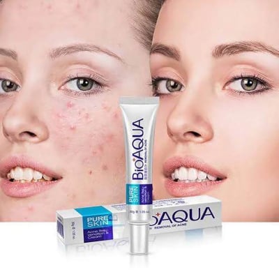 Picture of Bioaqua Pure Skin Acne Removal & Rejuvenation Cream For Men and Women -30gm