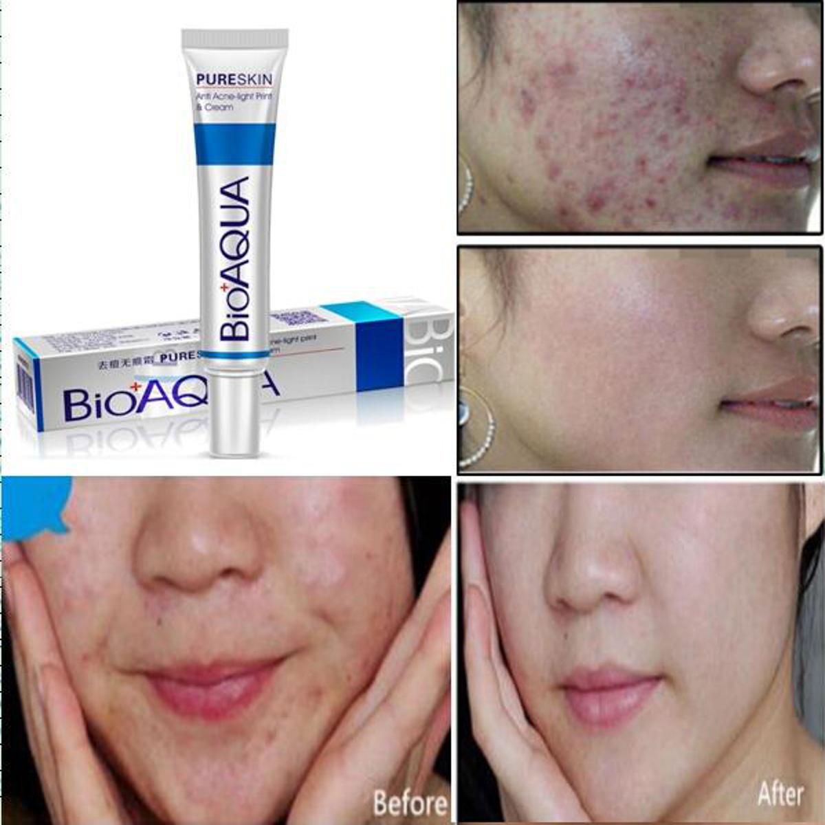 Picture of BIOAQUA  Pure Skin Acne Rejuvenation Cream - 30g