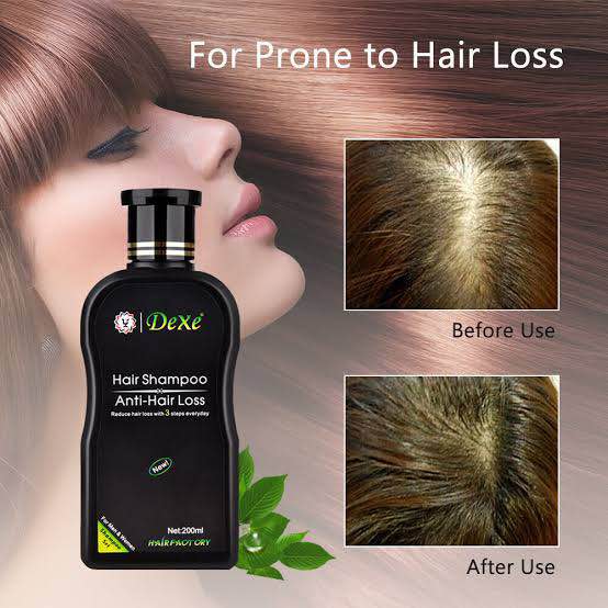 Picture of DEXE Anti-Hair Loss Hair Growth Shampoo Treatment Natural Ingredients 200ml