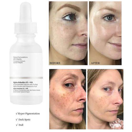 Picture of THE ORDINARY. Alpha Arbutin 2% + HA size -30ml