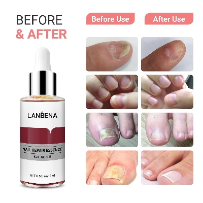 Picture of LANBENA Nail Repair Essence Serum - 12ml