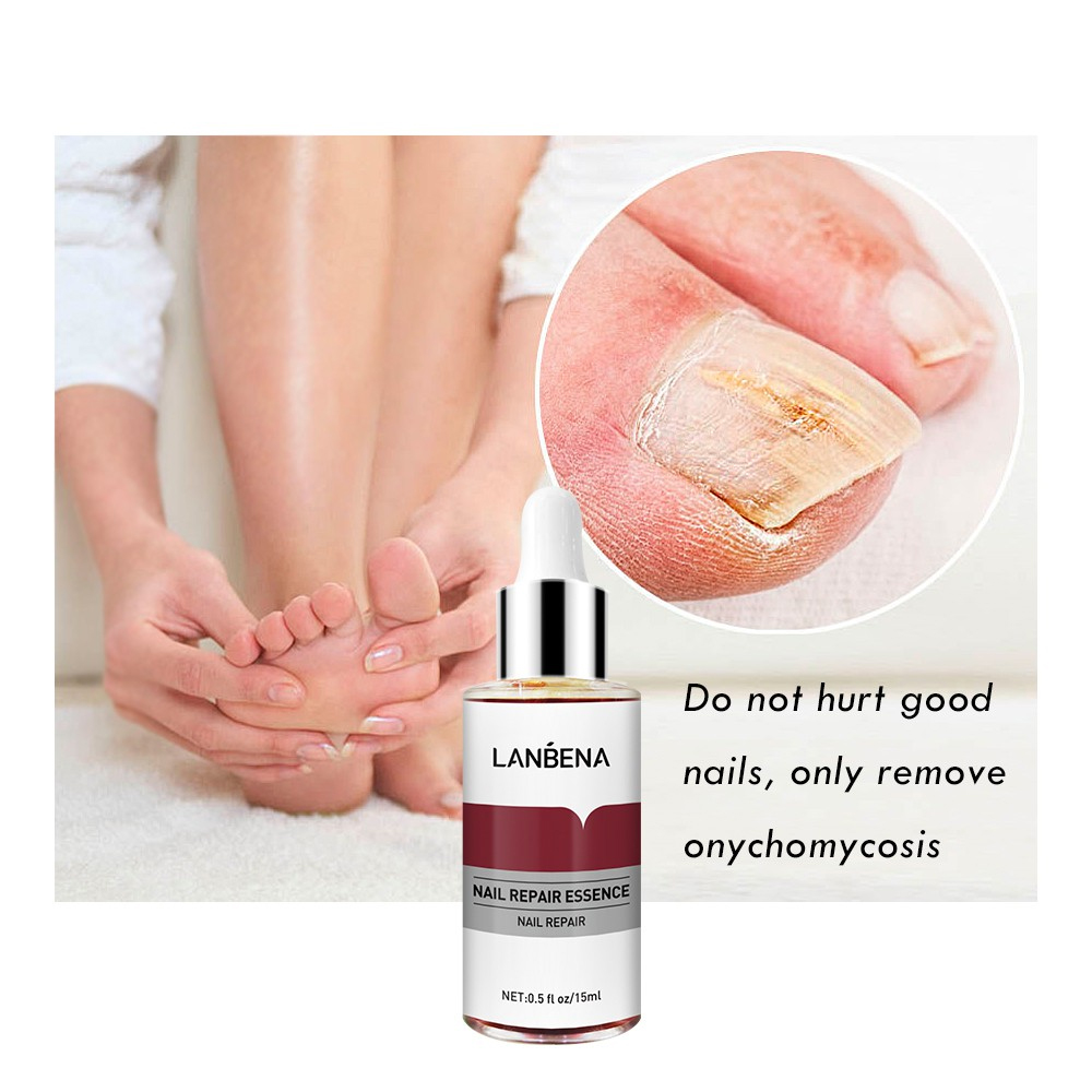 Picture of LANBENA Nail Repair Essence Serum - 12ml