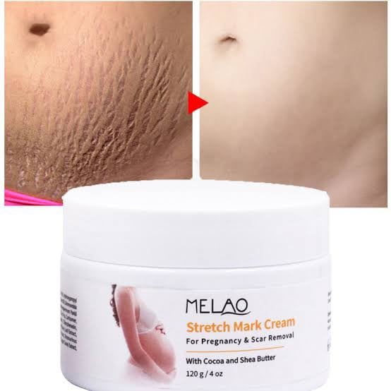 Picture of MELAO Women Remove Pregnancy Scars Acne Cream Stretch Marks Treatment Maternity Repair Anti-Aging  Body Creams-120gm