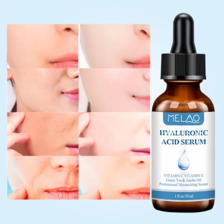 Picture of MELAO Hyaluronic Acid Serum,Moisturizing Anti-Aging Remove Wrinkles Freckles and Spots Vitamin C Serum for Deeply Moisturizes and Improves Facial Elasticity and Tightens-30ml