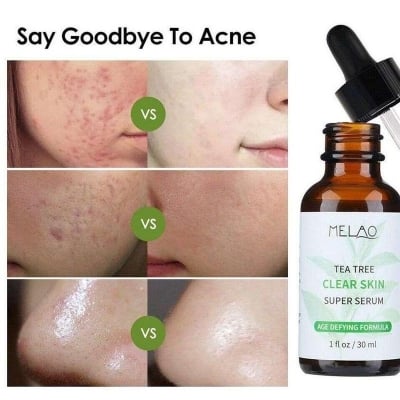 Picture of MELAO TEA TREE CLEAR SKIN SUPER SERUM-30ml