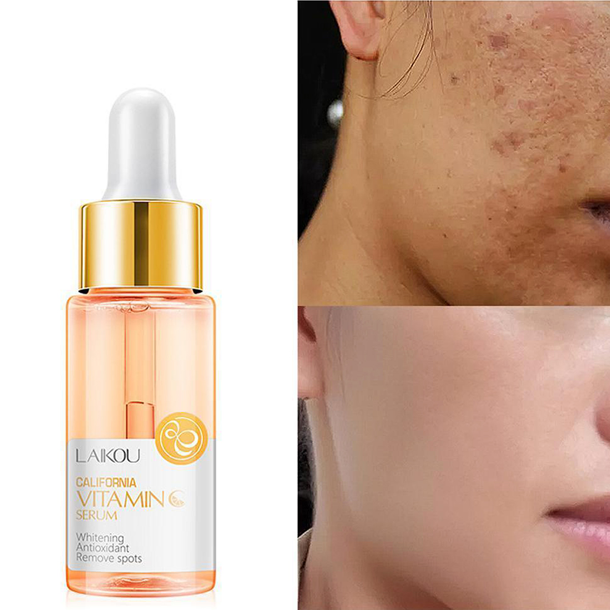 Picture of Laikou Sakura & Vitamin C Serum Combo ( 17 ml +17ml )-2pcs