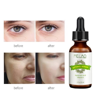 Picture of MELAO Retinol Serum Anti Fine Lines Remove Essence Fade Dark Spots-30ml