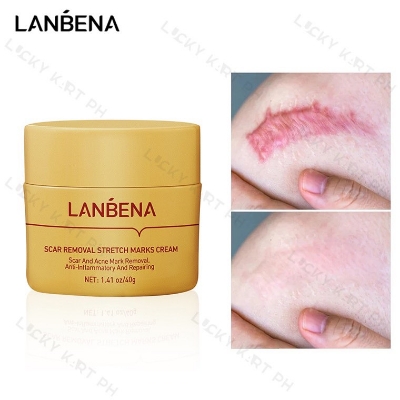 Picture of LANBENA Scar Remover Cream Repair Serum Stretch Mark Blackhead Acne Spots TCM Removal Gel Whitening Face Body Essence-40GM