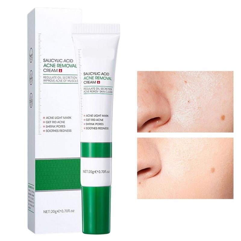 Picture of BIOAQUA Salicylic Acid Acne Removal Cream Acne Treatment Face Creams Moisturizing Blackhead Remover skincare Facial Cream-20gm