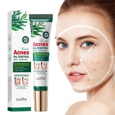 Picture of SADOER Mild and Pure Tea Tree Gel Acne removing and Oil Control Anti Acne Soothing gel- 20g