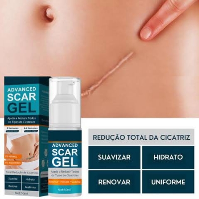 Picture of Jaysuing Advanced Scar Gel, Scar Removal for Surgical Scars, Acne Scar Removal Cream-50gm