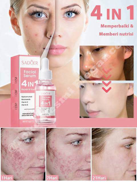 Picture of Sadoer 4 IN 1 Repair and Nourish Facial Serum – 30ml