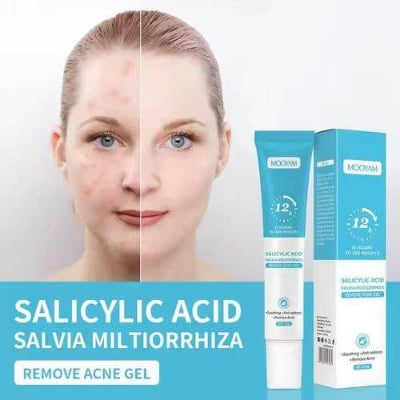 Picture of MOOYAM Salicylic Acid Remove Acne Gel For Stubborn Acne Pimple Breakouts-20gm