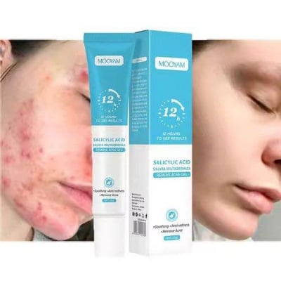 Picture of MOOYAM Salicylic Acid Remove Acne Gel For Stubborn Acne Pimple Breakouts-20gm
