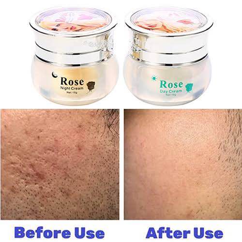 Picture of FEIQUE 2pcs Rose Cream Set Purifying Nutrient Anti-Freckle Anti-Wrinkle Nourishing Renewing Moisturize Day&Night Cream
