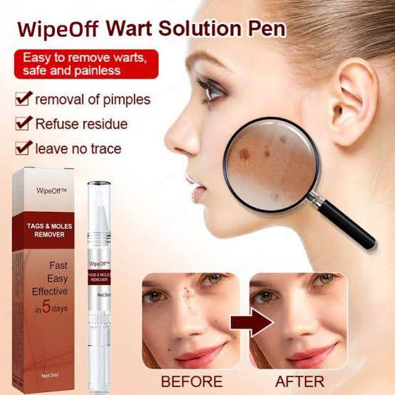 Picture of Moles Remover Pen West Month Tags 3 Ml