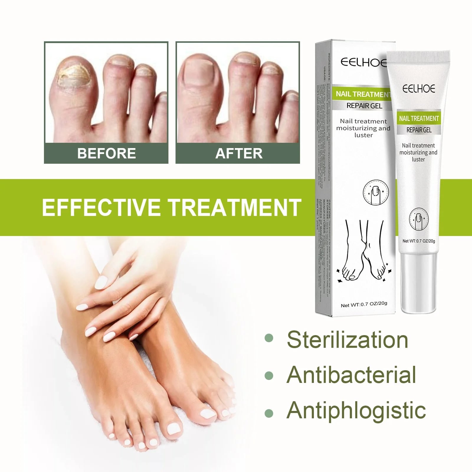 Picture of EELHOE Nail Fungus Treatment Repair Gel-20gm