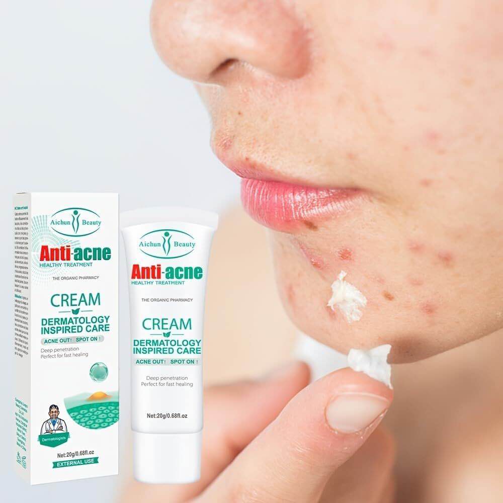 Picture of AICHUN BEAUTY Anti-Acne Cream Treats Pimple Clogged Pores Oil Control Reduces Acne Scars Shrinks Pores 20g