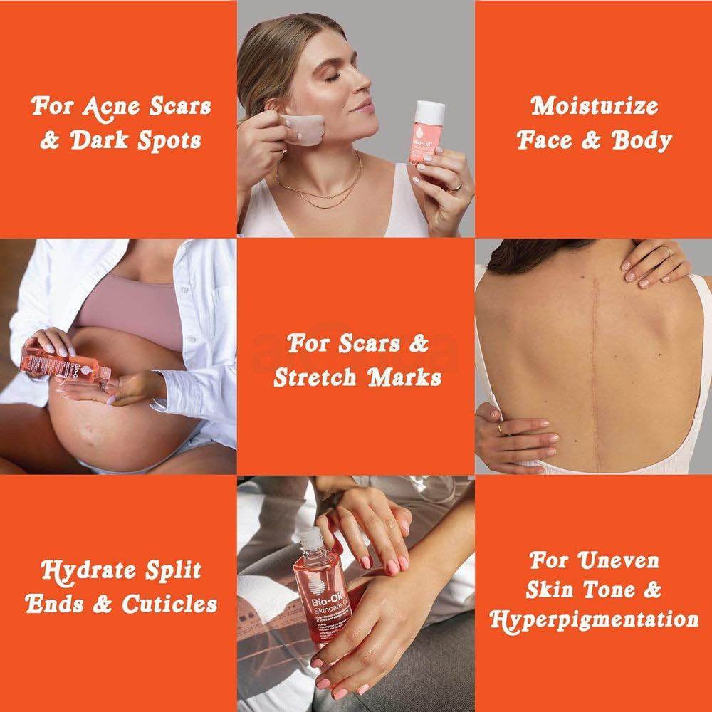Picture of Bio-Oil Skincare Oil - 125ml Specialist Skin Care Oil - Scars, Stretch Mark, Ageing, Uneven Skin Tone
