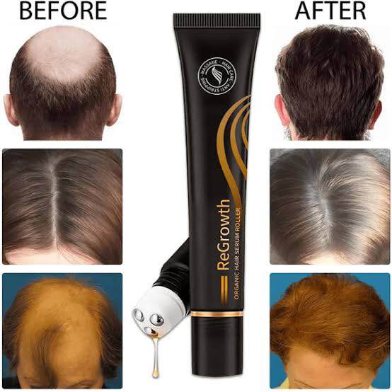 Picture of EELHOE Essence Massage to promote scalp absorption Anti Hair Loss 100% Pure Natural Treatment Hair Loss Hair -20ml