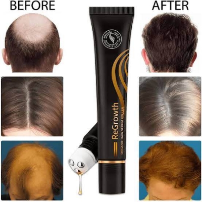 Picture of EELHOE Essence Massage to promote scalp absorption Anti Hair Loss 100% Pure Natural Treatment Hair Loss Hair -20ml