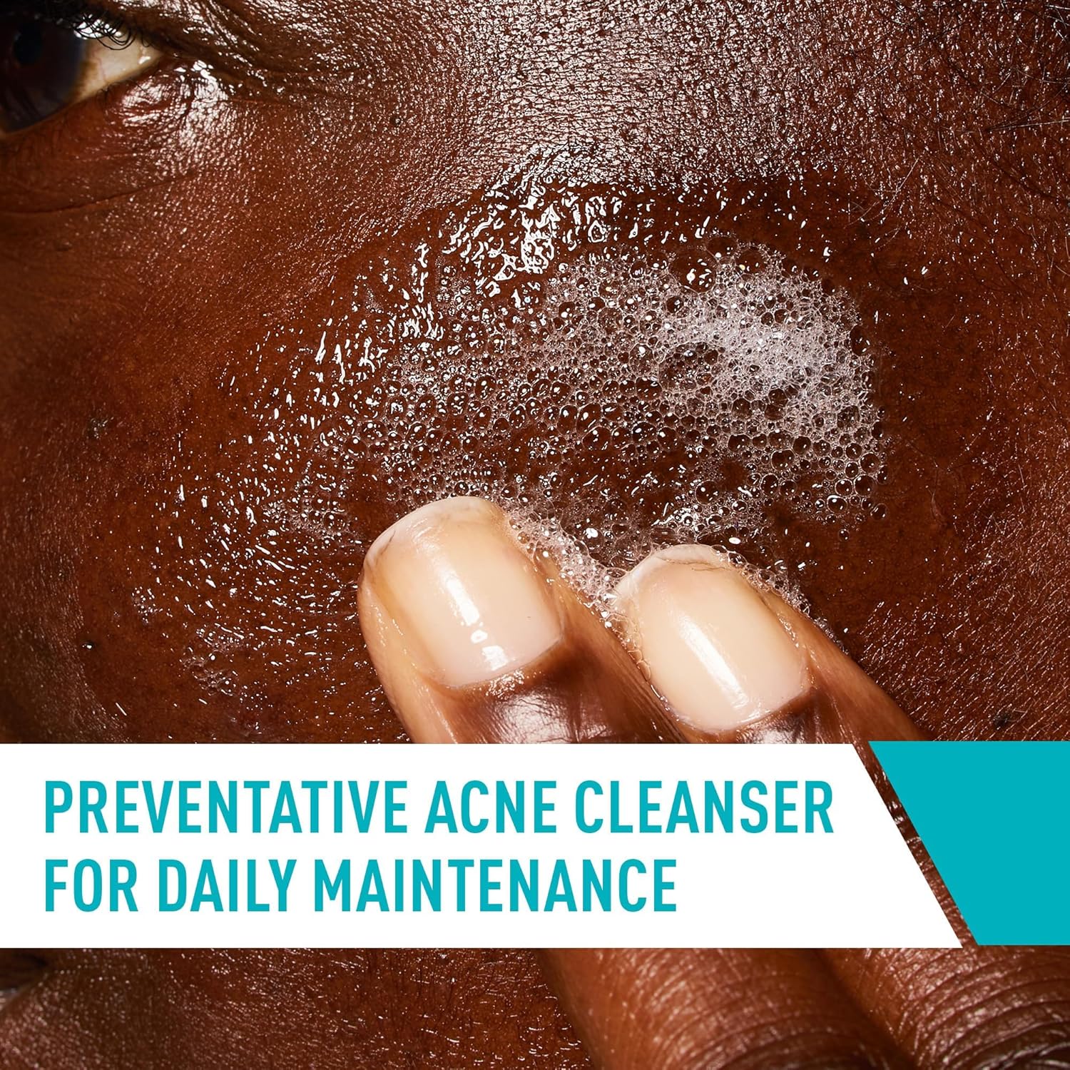 Picture of Cerave Acne Control Cleanser 237 Ml Skin Care Product White