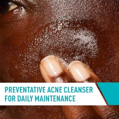 Picture of Cerave Acne Control Cleanser 237 Ml Skin Care Product White