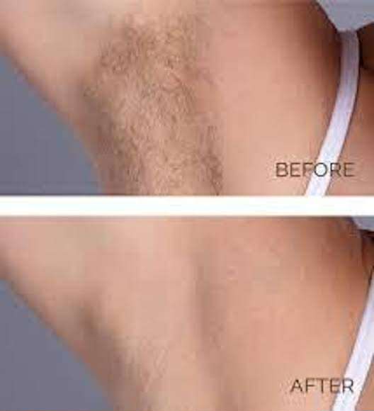 Picture of BEAUTE 3D Underarm Whitening Cure Cream new