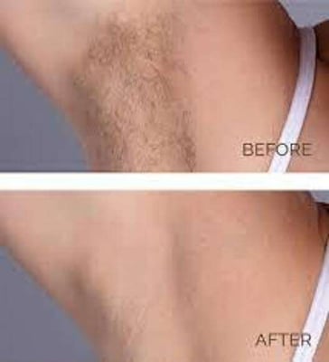Picture of BEAUTE 3D Underarm Whitening Cure Cream new