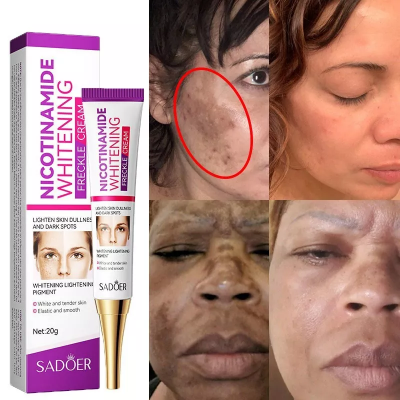 Picture of SADOER Whitening and Freckle Removal Cream Moisturizing Moisturizing and Fading Niacinamide Cream-20gm NEW